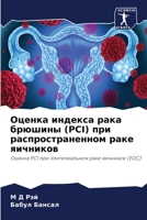 Оценка индекса рака брюшины (PCI) при распространенном раке яичников: Оценка PCI при эпителиальном раке яичников (EOC) 6205885271 Book Cover