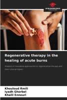 Regenerative therapy in the healing of acute burns 620857479X Book Cover