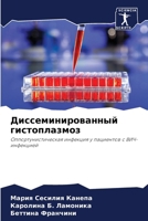 Диссеминированный гист&# 6207037626 Book Cover