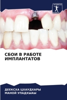 СБОИ В РАБОТЕ ИМПЛАНТАТОВ 6206083950 Book Cover