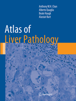 Atlas of Liver Pathology 1493943537 Book Cover