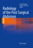 Radiology of the Post Surgical Abdomen 1447127749 Book Cover