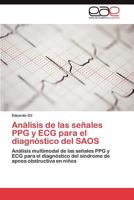 Análisis de las señales PPG y ECG para el diagnóstico del SAOS 3846576670 Book Cover