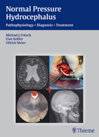 NPH - Normal Pressure Hydrocephalus: Pathophysiology - Diagnosis - Treatment 3131646012 Book Cover