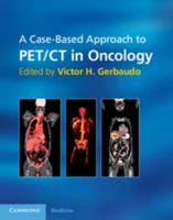 A Case-Based Approach to Pet/CT in Oncology 052111683X Book Cover