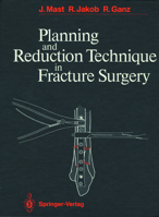 Planning and Reduction Technique in Fracture Surgery 3642647847 Book Cover