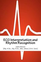 ECG Interpretation and Rhythm Recognition 1479339687 Book Cover