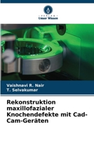 Rekonstruktion maxillofazialer Knochendefekte mit Cad-Cam-Geräten (German Edition) 6206517772 Book Cover