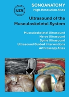 Sonoanatomy - High-Resolution Atlas - Ultrasound of the Musculoskeletal System: Musculoskeletal Ultrasound, Nerve Ultrasound, Spine Ultrasound, Ultrasound Guided Interventions, Arthroscopy Atlas 3769309138 Book Cover