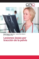 Lesiones �seas por tracci�n de la pelvis 6202252146 Book Cover
