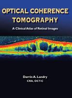 Optical Coherence Tomography 0984193448 Book Cover