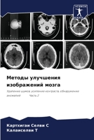 Методы улучшения изображений мозга: Удаление шумов, усиление контраста, обнаружение аномалий Часть 2 6205841487 Book Cover