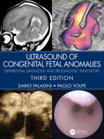 Ultrasound of Congenital Fetal Anomalies: Differential Diagnosis and Prognostic Indicators 0367499509 Book Cover