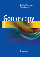 Gonioscopy 3662521164 Book Cover