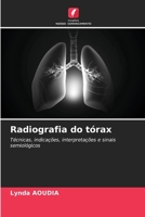 Radiografia do tórax (Portuguese Edition) 6208570425 Book Cover