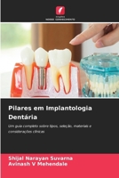Pilares em Implantologia Dentária (Portuguese Edition) 6208632056 Book Cover
