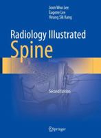 Radiology Illustrated: Spine 9819966116 Book Cover