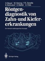 Röntgendiagnostik Von Zahn Und Kiefererkrankungen: Ein Klinisch Radiologisches Konzept 3642710646 Book Cover