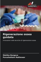 Rigenerazione ossea guidata (Italian Edition) 620990694X Book Cover