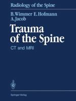 Trauma of the Spine: CT and MRI 3642456685 Book Cover