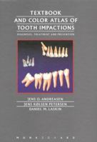 Textbook and Color Atlas of Tooth Impactions: Diagnosis Treatment Prevention 8716106938 Book Cover