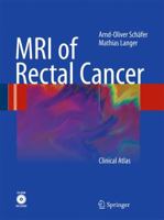 MRI of Rectal Cancer: Clinical Atlas [With CDROM] 3540728325 Book Cover