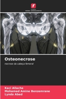 Osteonecrose: necrose da cabeça femoral 6205923750 Book Cover