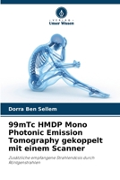 99mTc HMDP Mono Photonic Emission Tomography gekoppelt mit einem Scanner: Zusätzliche empfangene Strahlendosis durch Röntgenstrahlen 6206067580 Book Cover
