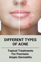 Different Types Of Acne: Topical Treatments For Psoriasis, Atopic Dermatitis B09MCB4DB5 Book Cover