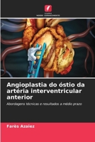 Angioplastia do óstio da artéria interventricular anterior (Portuguese Edition) 6208177308 Book Cover