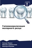 Гипоминерализация молярного резца 6204153714 Book Cover