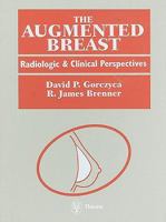 The Augmented Breast: Radiologic and Clinical Perspectives 0865776121 Book Cover