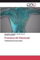 Fractura de Clavicula 6200396698 Book Cover
