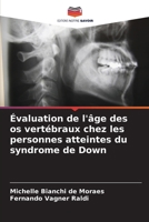 Évaluation de l'âge des os vertébraux chez les personnes atteintes du syndrome de Down (French Edition) 6207631196 Book Cover