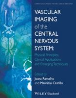 Vascular Imaging of the Central Nervous System: Physical Principles, Clinical Applications, and Emerging Techniques 1118188756 Book Cover