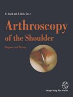 Arthroscopy of the Shoulder: Diagnosis and Therapy 3709192056 Book Cover