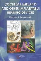 Cochlear Implants and Other Implantable Hearing Devices 159756432X Book Cover