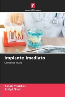 Implante imediato 6206987981 Book Cover