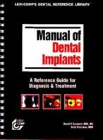 Lexi Comp's Manual Of Dental Implants (Lexi Comp's Dental Reference Library) 1591950619 Book Cover