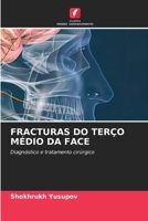 Fracturas Do Terço Médio Da Face (Portuguese Edition) 6207894251 Book Cover