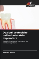Opzioni protesiche nell'odontoiatria implantare (Italian Edition) 6630218728 Book Cover