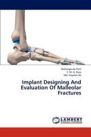 Implant Designing and Evaluation of Malleolar Fractures 3847321153 Book Cover