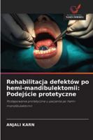 Rehabilitacja defektów po hemi-mandibulektomii: Podejscie protetyczne 6209252230 Book Cover