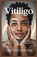 Vitiligo: Das Geheimnis der Hautdepigmentierung verstehen: Ursachen, Behandlungen und Auswirkungen im wirklichen Leben B0FWX9X793 Book Cover