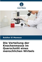Die Verteilung der Knochenmasse im Querschnitt eines menschlichen Wirbels (German Edition) 6208054192 Book Cover