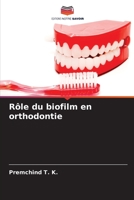 Rôle du biofilm en orthodontie 6206029425 Book Cover
