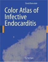 Color Atlas of Infective Endocarditis 1852339373 Book Cover