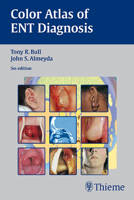 Color Atlas of ENT Diagnosis 3131293950 Book Cover