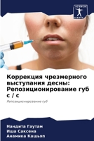 Коррекция чрезмерного ... ... с / с 6206094642 Book Cover