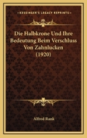 Die Halbkrone Und Ihre Bedeutung Beim Verschluss Von Zahnlucken (1920) (German Edition) 1146086938 Book Cover